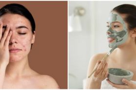 5 Cara mengatasi wajah mengelupas dan perih pakai masker alami