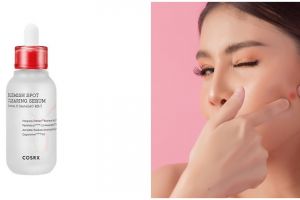 4 Manfaat serum COSRX AC Collection Blemish Spot, bikin wajah segar