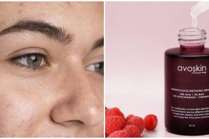7 Serum Avoskin untuk wajah berjerawat, harga mulai Rp 139 ribu
