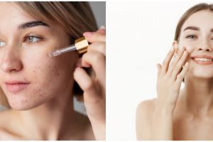 7 Rekomendasi skincare untuk kulit bertekstur di bawah Rp 150 ribu