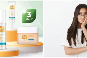 5 Series Safi Skincare Acne Expert, bantu atasi wajah berminyak