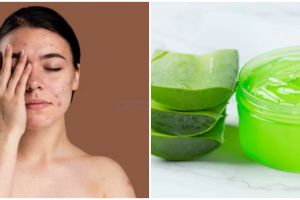 7 Cara hilangkan kemerahan di wajah karena iritasi, alami dan mudah