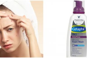 9 Cetaphil skincare untuk kulit berjerawat, harga mulai Rp 190 ribu