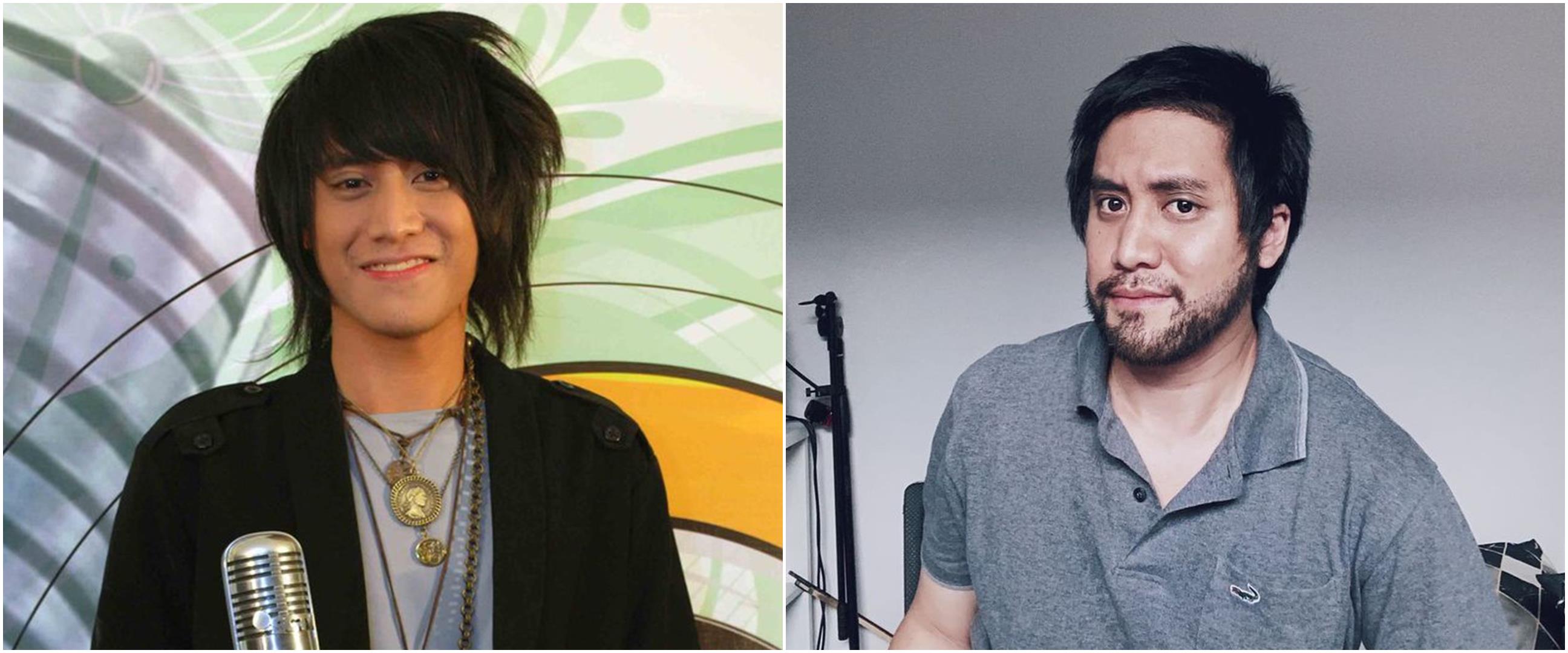 9 Foto dulu vs kini Kevin Aprilio, manglingi usai transplantasi rambut