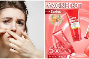 4 Produk skincare Somethinc untuk atasi jerawat di bawah Rp 100 ribu