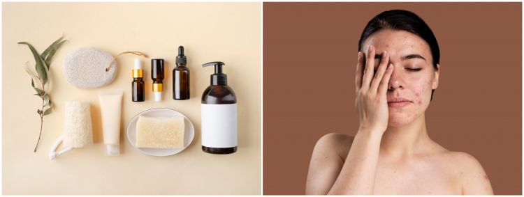 9 Produk Skincare Nacific, atasi masalah jerawat hingga kulit kering