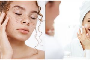 10 Skincare untuk menghilangkan melasma, harga di bawah Rp 200 ribu