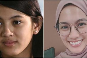 11 Potret dulu dan kini Alyssa Soebandono, disebut kian kurus