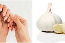 9 Cara membuat kuku berkilau secara alami, gunakan bawang putih