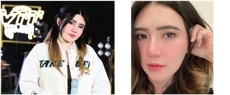 6 Perawatan wajah Via Vallen, pakai infus kromosom