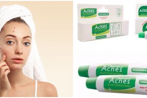 11 Acne spot gel atasi wajah berjerawat, harga di bawah Rp 100 ribu