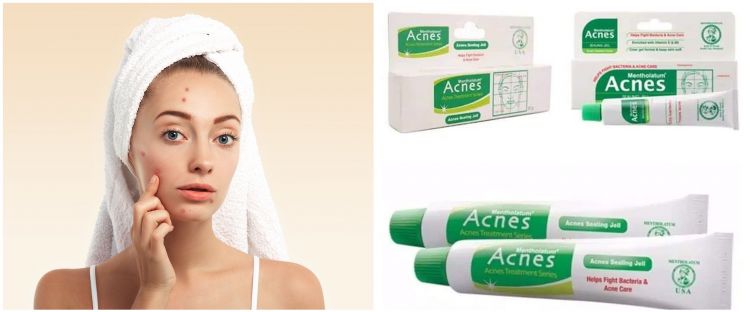 11 Acne spot gel atasi wajah berjerawat, harga di bawah Rp 100 ribu