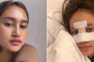 11 Potret kondisi Permesta Dhyaz usai angkat implan, alami sulit napas