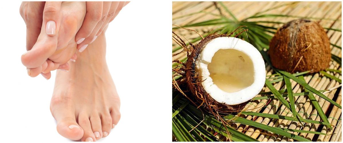 11 Cara menghilangkan bekas luka di kaki secara alami, mudah dila