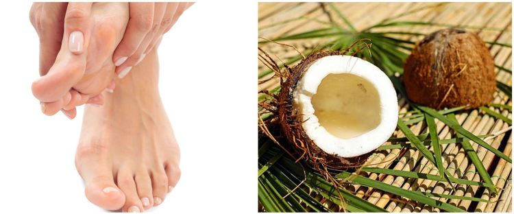 11 Cara menghilangkan bekas luka di kaki secara alami, mudah dilakukan