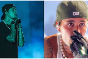 Justin Bieber derita sindrom Ramsay Hunt, alami kelumpuhan wajah
