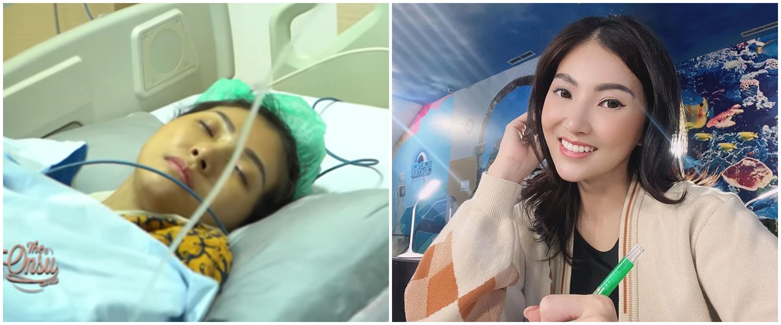 Dilarikan ke rumah sakit karena migrain, Sarwendah jalani operasi