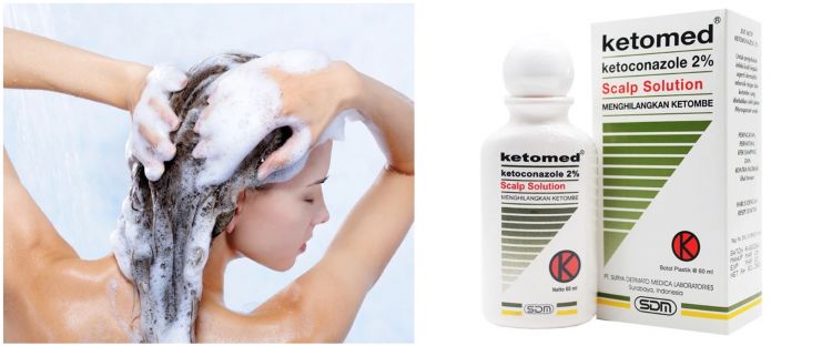 11 Scalp sampo di bawah Rp 200 ribu, jaga kesehatan kulit kepala