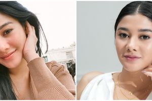 7 Skincare kulit kombinasi Naysila Mirdad, kontrol minyak berlebih