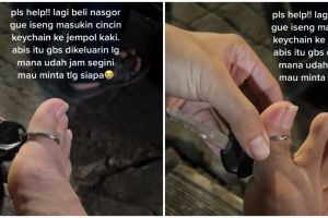 Iseng sambil tunggu pesanan, jempol pria ini mengalami hal tak terduga