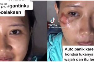 Jelang nikah manten ini kecelakaan, intip transformasinya usai dirias