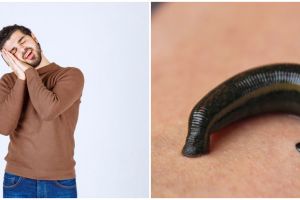 9 Arti mimpi tentang lintah, punya makna mendalam