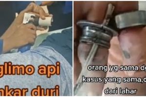 Ngilu, momen petugas damkar potong cincin laher motor di jari pria
