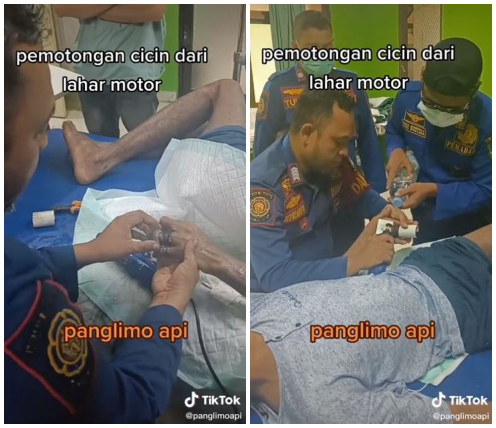 Jari pria terjebak cincin dari bearing motor, sampai ditolong damkar