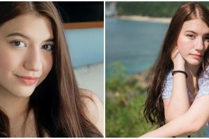 5 Skincare rutin Cassandra Lee ini bikin wajah glowing & bebas jerawat