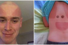 15 Potret lucu orang lupa pakai sunscreen, perubahan warna beda banget