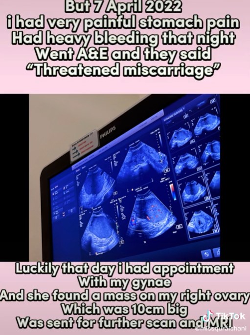 Kisah perjuangan ibu hamil penderita kanker stadium 4, bikin terenyuh