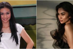 Mengaku sedot lemak pipi, ini 11 potret dulu dan kini Ariel Tatum