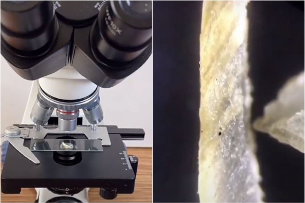 Bikin syok, ini 'penghuni' kuku saat dilihat pakai mikroskop 