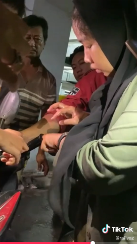 Jari tersangkut di stang motor, tingkah wanita ini bikin heran