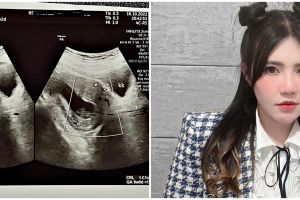 Cerita Via Vallen pertahankan janin hingga pendarahan dan pingsan