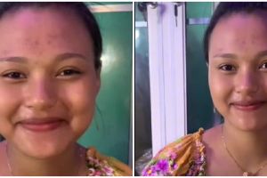 Wanita ini maternity shoot dirias suami, hasilnya manglingi abis