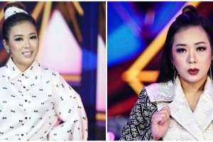 Potret Soimah usai operasi kantung mata, dipuji makin memesona