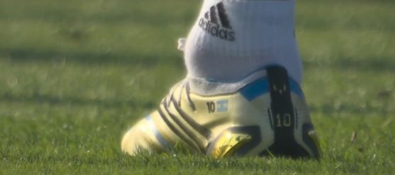 Kondisi aneh pergelangan kaki Lionel Messi sebelum Argentina kalah