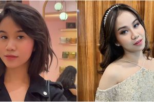 Kondisi Mayang pascaoperasi hidung disorot, disebut mirip Evi Masamba