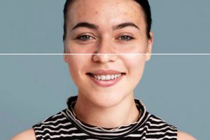 Tips merawat wajah saat skin barrier rusak, cuma pakai tiga produk