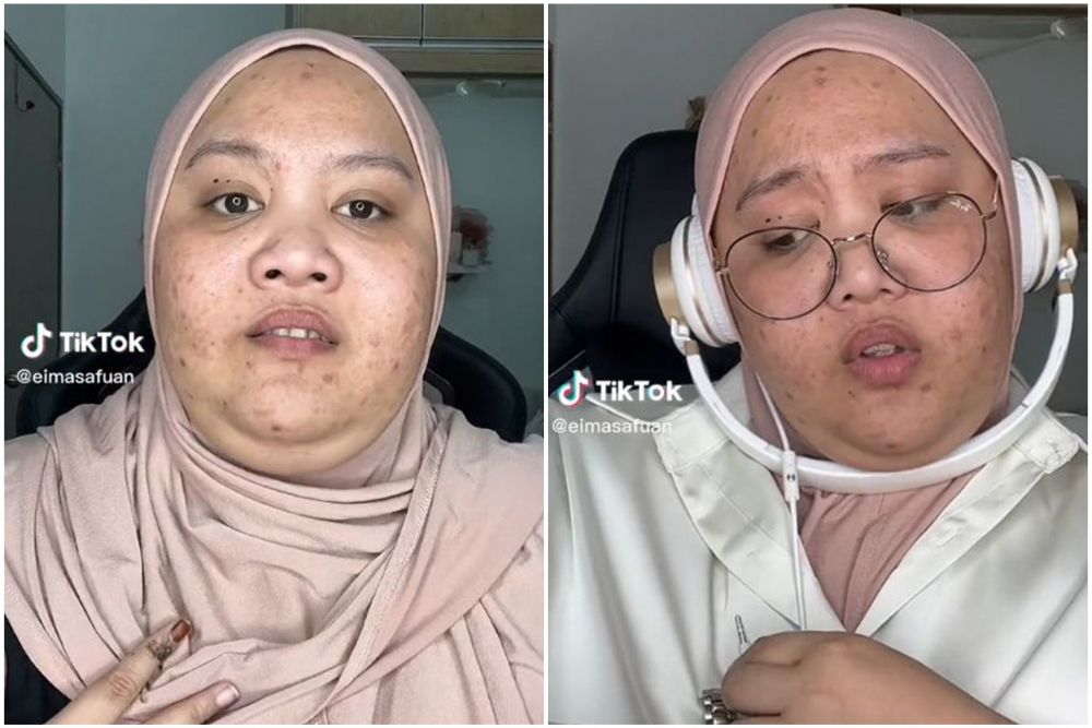 Transformasi makeup wanita berjerawat jadi tampak mulus & tirus ini bikin takjub, dikira beda orang