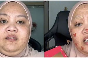 Transformasi makeup wanita berjerawat jadi tampak mulus & tirus ini bikin takjub, dikira beda orang