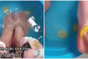 Cara menghilangkan tumit kasar dan bau kaki, cuma pakai 2 bahan dapur