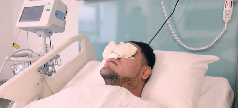Ivan Gunawan bongkar biaya operasi hidung di Turki, rela keluarkan hingga ratusan juta
