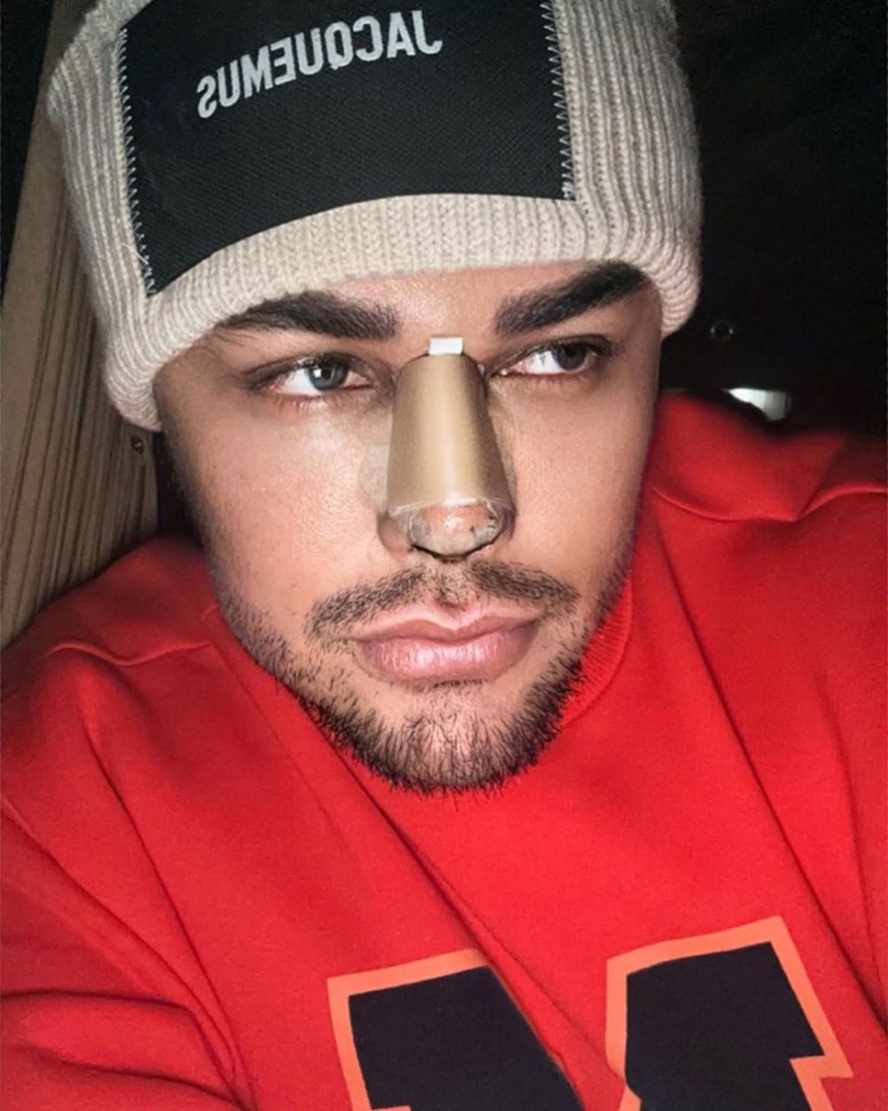 Ivan Gunawan bongkar biaya operasi hidung di Turki, rela keluarkan hingga ratusan juta