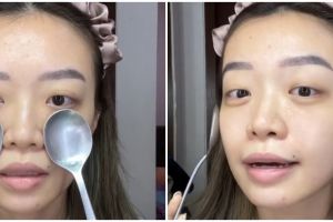 Cara mengatasi mata sembap ini simpel, cuma pakai satu alat