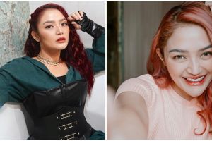 Dituding jalani operasi plastik, ini jawaban menohok Siti Badriah