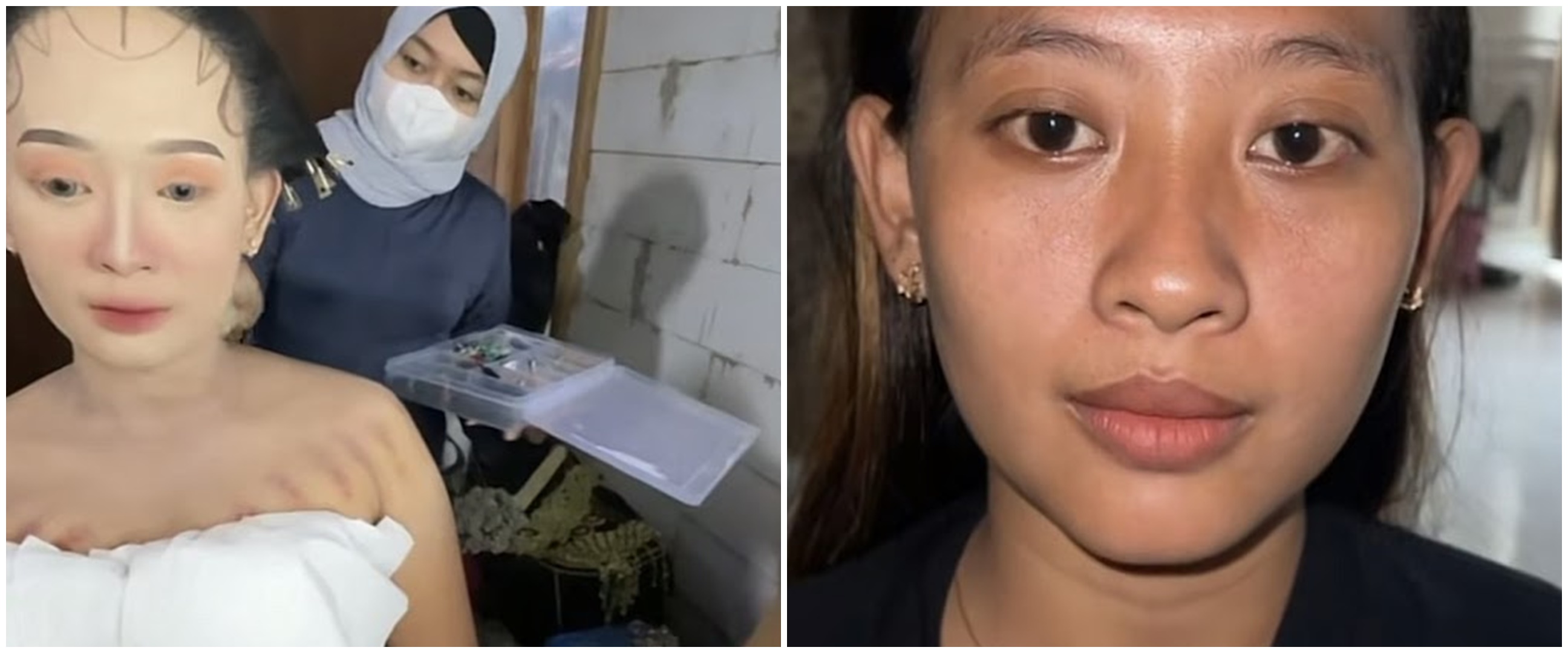 Manten punya bekas kerokan dirias MUA pakai paes Jawa hasilnya bikin takjub, skill perias panen pujian