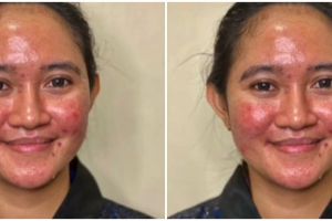Transformasi wanita berjerawat dirias MUA jadi pengantin Jawa, bikin pangling