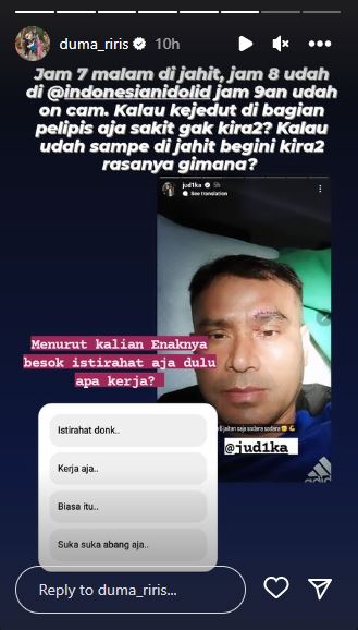 Profesionalisme Judika dipuji, tetap jadi juri Indonesian Idol usai pelipisnya sobek